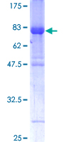 12.5% SDS-PAGE Stained with Coomassie Blue